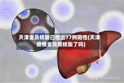 天津全员核酸已检出77例阳性(天津疫情全员做核酸了吗)