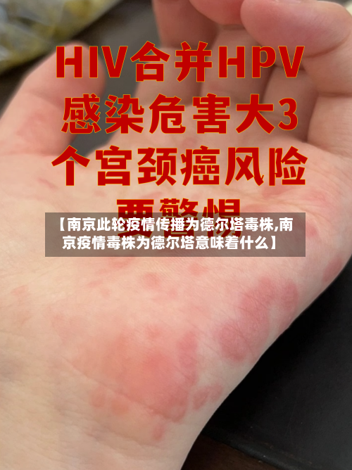 【南京此轮疫情传播为德尔塔毒株,南京疫情毒株为德尔塔意味着什么】