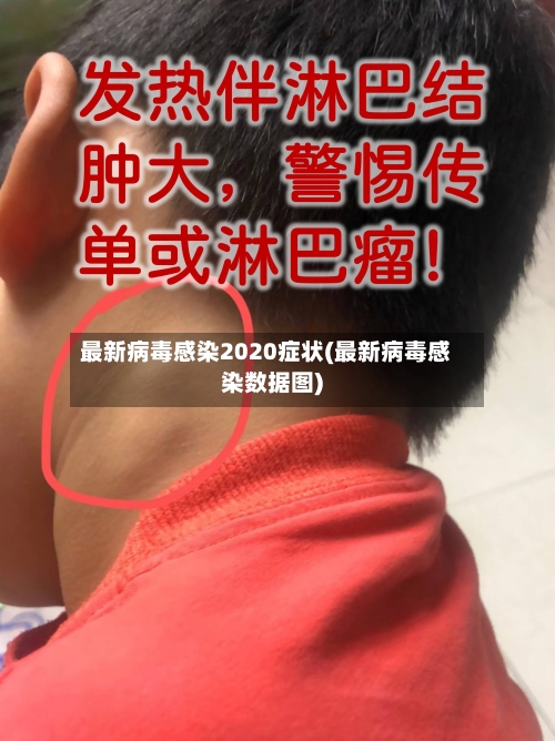 最新病毒感染2020症状(最新病毒感染数据图)-第2张图片