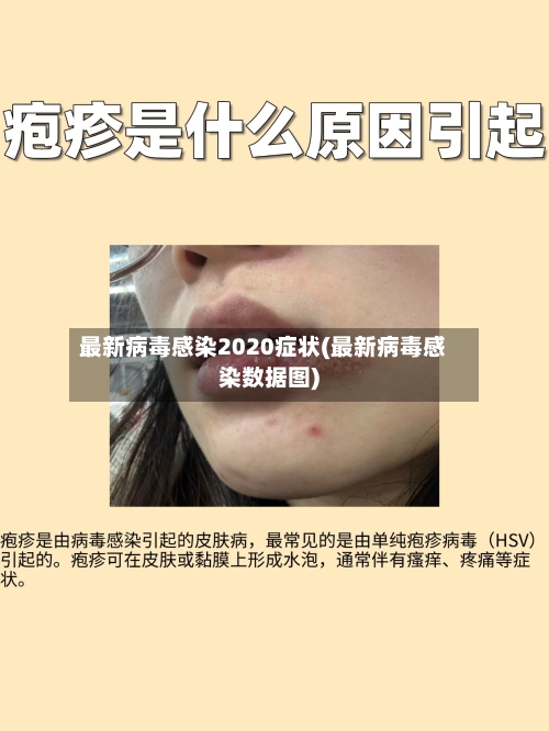 最新病毒感染2020症状(最新病毒感染数据图)-第3张图片