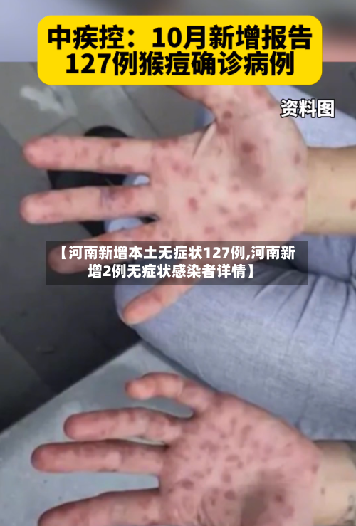 【河南新增本土无症状127例,河南新增2例无症状感染者详情】-第2张图片