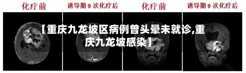 【重庆九龙坡区病例曾头晕未就诊,重庆九龙坡感染】-第2张图片