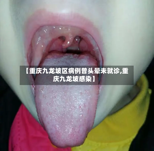 【重庆九龙坡区病例曾头晕未就诊,重庆九龙坡感染】