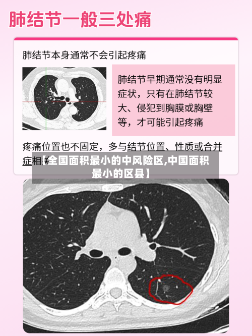 【全国面积最小的中风险区,中国面积最小的区县】-第2张图片