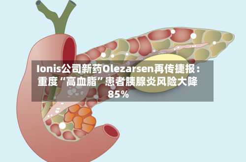 Ionis公司新药Olezarsen再传捷报：重度“高血脂	”患者胰腺炎风险大降85%-第2张图片