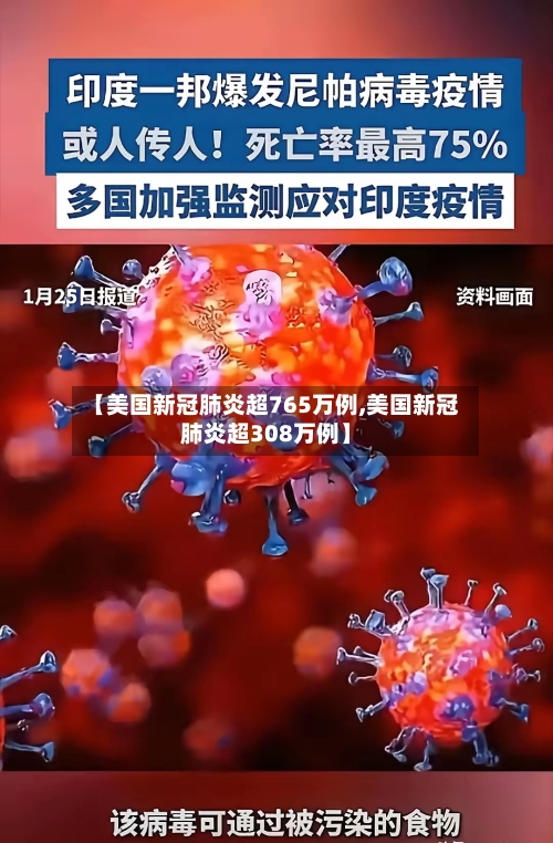 【美国新冠肺炎超765万例,美国新冠肺炎超308万例】