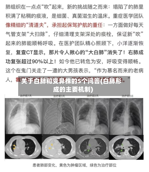关于白肺和变异株的5个问答(白肺形成的主要机制)