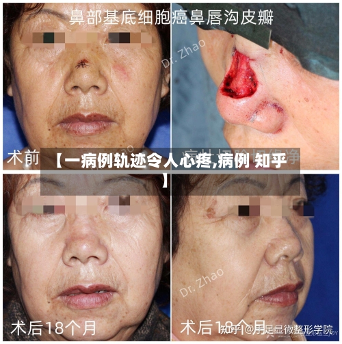 【一病例轨迹令人心疼,病例 知乎】-第2张图片