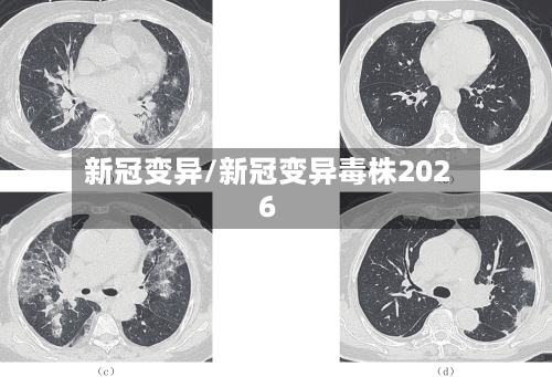 新冠变异/新冠变异毒株2026-第3张图片