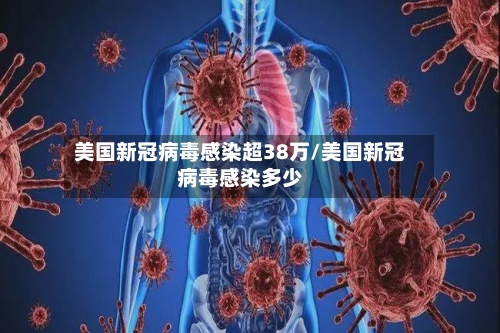 美国新冠病毒感染超38万/美国新冠病毒感染多少