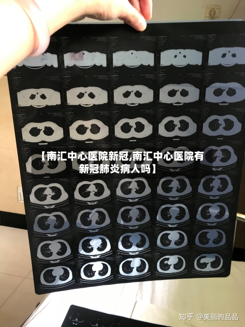 【南汇中心医院新冠,南汇中心医院有新冠肺炎病人吗】-第2张图片