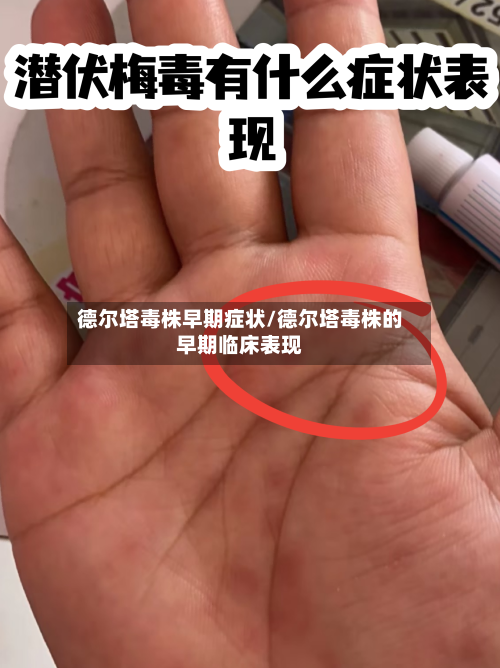 德尔塔毒株早期症状/德尔塔毒株的早期临床表现