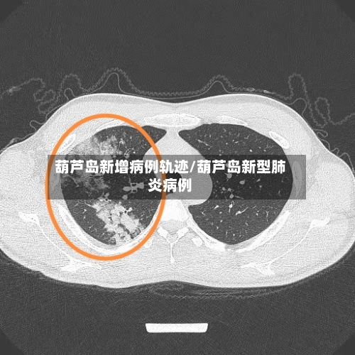 葫芦岛新增病例轨迹/葫芦岛新型肺炎病例