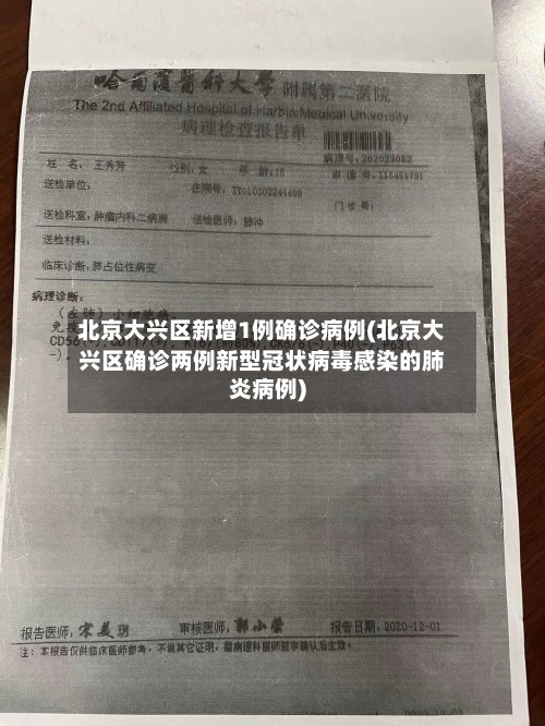 北京大兴区新增1例确诊病例(北京大兴区确诊两例新型冠状病毒感染的肺炎病例)-第3张图片