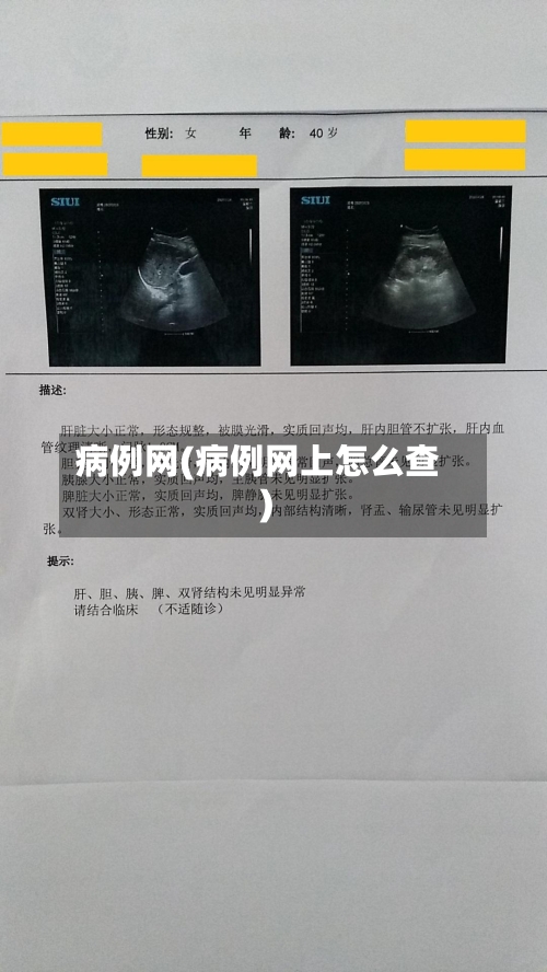 病例网(病例网上怎么查)-第2张图片