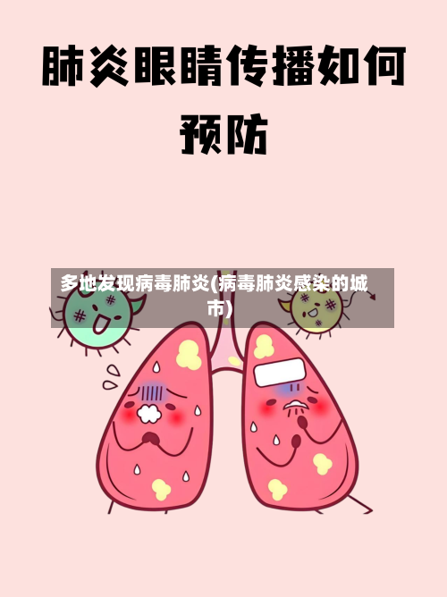 多地发现病毒肺炎(病毒肺炎感染的城市)