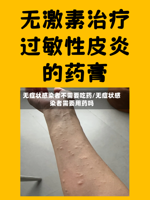 无症状感染者不需要吃药/无症状感染者需要用药吗