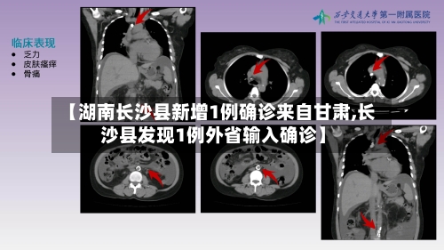 【湖南长沙县新增1例确诊来自甘肃,长沙县发现1例外省输入确诊】
