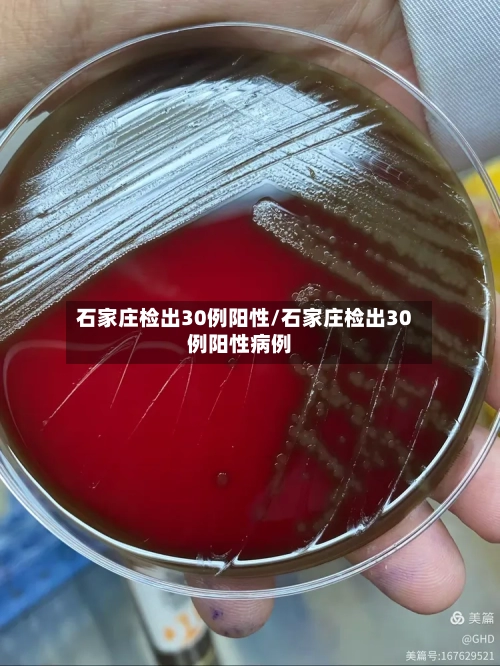 石家庄检出30例阳性/石家庄检出30例阳性病例-第2张图片