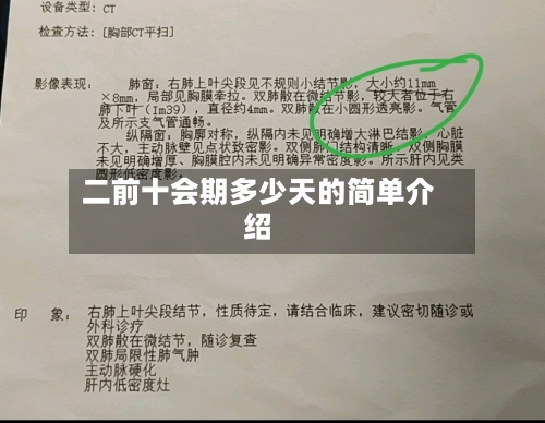 二前十会期多少天的简单介绍-第2张图片