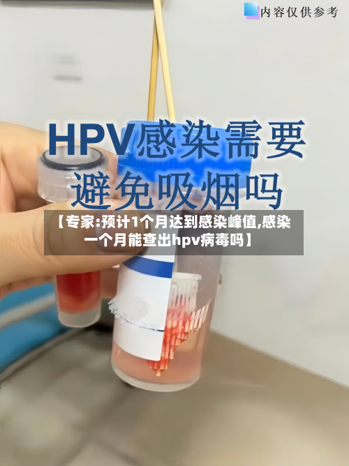 【专家:预计1个月达到感染峰值,感染一个月能查出hpv病毒吗】-第2张图片
