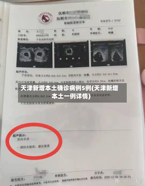 天津新增本土确诊病例5例(天津新增本土一例详情)